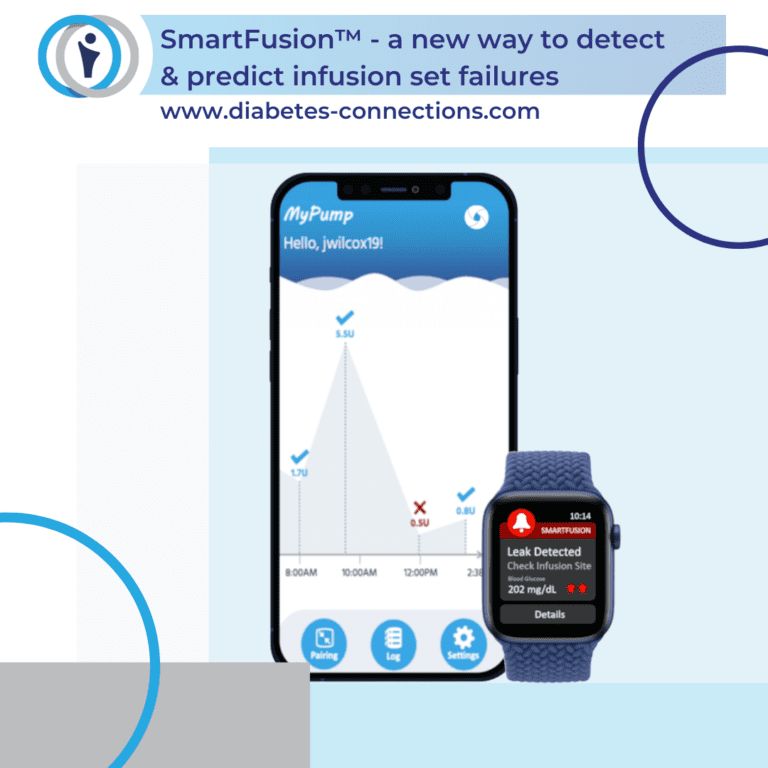 SmartFusion™ is a new way to detect & predict infusion set failures